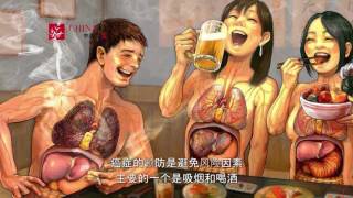 Vivir: Cáncer de Cabeza y Cuello
