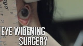 TGK Films - Eye Widening Surgery