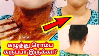 How to get rid of Darkneck ?Simple and effectively working remedies