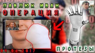 ПАВЛЮК ИВАН ПОСЛЕ ОПЕРАЦИИ - Видео Влог - Блог - Интервю по скайпу