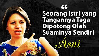 #KisahNyata | Seorang Istri yang Tangannya Tega Dipotong Oleh Suaminya Sendiri | Asni