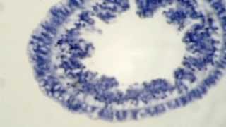 تحت المجهر : الهيدرا (مقطع عرضي) Under Microscope: Hydra (cross section)