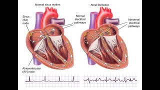 4 things I do to help my afib - magnesium B12 Dr Gupta logbook