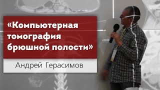 Компьютерная томография органов брюшной полости