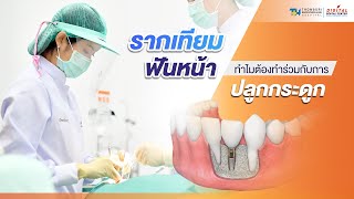 รากเทียมฟันหน้า ทำไมต้องทำร่วมกับการปลูกกระดูก | Digital Dental Center