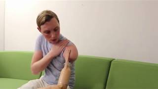 Osseointegration advantages and drawbacks - Triple amputee Christoffer Lindhe - Vlog 30