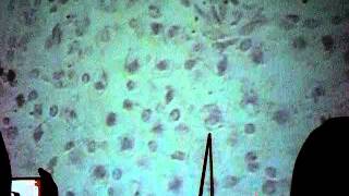 Ovario y Trompa uterina