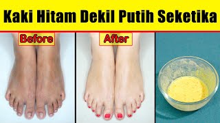 HANYA 5 MENIT, CARA TERAMPUH MEMUTIHKAN KAKI DAN TANGAN HITAM DEKIL DALAM HITUNGAN HARI