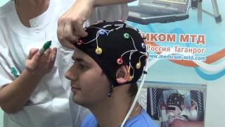 Комплект ЭЭГ-электродов Энцефалан-КЭ для видео ЭЭГ мониторинга, ЭЭГ-холтера