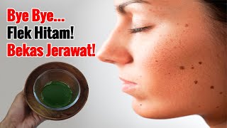 CUMA 5 MENIT... CARA MENGHILANGKAN FLEK HITAM DI WAJAH SECARA ALAMI DAN CEPAT