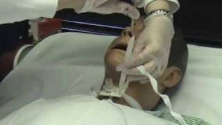 Trach Care Part 2