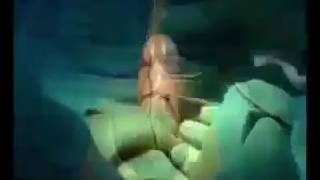 Transformation of male Organ to Female