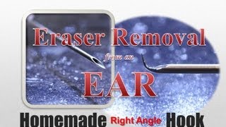 Pencil Eraser Removal From Ear