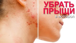 Как избавиться от прыщей в фотошопе за 5 минут!