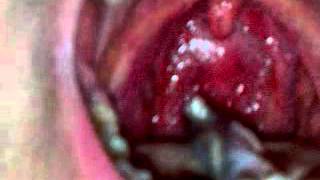 Me swallowing whole fish