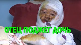 В Черновцах отец поджег 16-летнюю дочь: ​Стоял и молча наблюдал, как горела