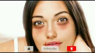 ৷চোখের নিচের কালো দাগ ম্যাজিকের মতো দূর হবে 100%গ্যারান্টি৷Remove Dark Circle৷ডার্ক সার্কেল দূর…