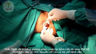 Phẫu thuật cắt trĩ bằng phương pháp Longo tại bệnh viện đa khoa Phố Nối