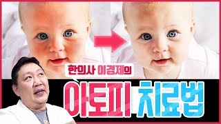 내 아이 '아토피' 치료할 수 있을까? (갓경제 도와줘요!)