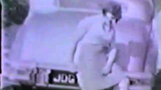 Pegleg RAK Right above knee female amputee old movie
