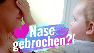 Nase gebrochen?! / Kinder Impfungen / 29.6.17 / MAGIXTHING