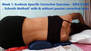 RECOUP Scoliosis Programme