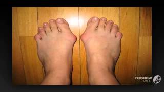 valgus pro отзывы

  - Valgus Pro оригинал
