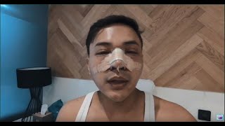 My Plastic Surgery Story Part 1 | NANA Plastic Surgery | Indonesian sub