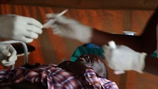 Uganda fights HIV with rubber band circumcision