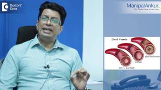 premature ejaculate treatment