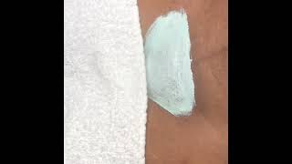 Brazilian Wax reaction on a first timer ?