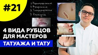 Классификация рубцов для мастеров татуажа и тату #удалениетату  #лазерноеудалениетату #обучение