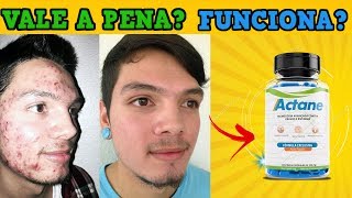 Actane Funciona Mesmo?Actane é bom?Actane preço ?Actane Onde Comprar? Como Tomar?