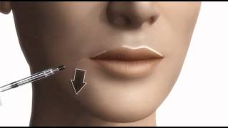 Contorno labios