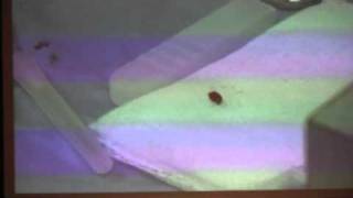DR. ROGER LEIR Implant Removal Footage