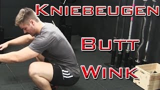 Kniebeuge | Butt Wink