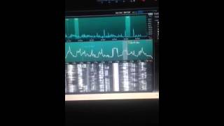 SDR Deluxe