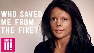 Who Saved Me From The Fire That Almost Killed Me? Finding The Truth