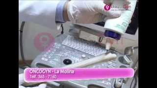 ONCOGYN: Ecografía transvaginal
