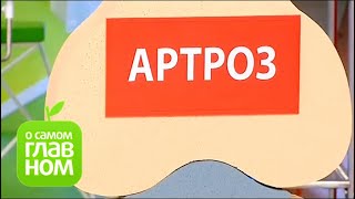 О самом главном: Артрит и артроз: симптомы, профилактика, лечение