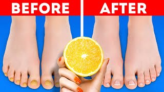 Cool Tips for your Feet and Shoes|| Pedicure hacks