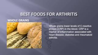 ALTERNATIVE MEDICINE AND NUTRITION FOR ARTHRITIS