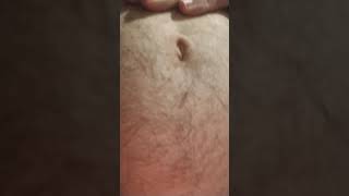 Quick bloated belly button
