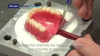 laboratoire prothèse dentaire algérie Vertex 0660571737