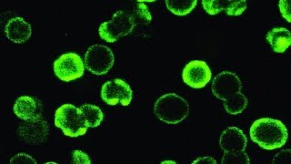 Ученые Петербурга изобрели микрокапсулы для лечения рака