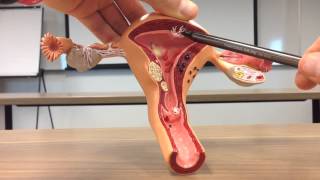 Female reproductive organ