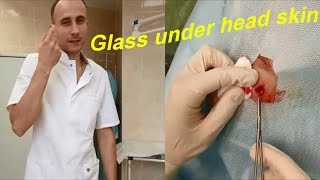Foreign Body Removal from Head // Стекло под кожей головы / Удаление
