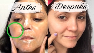 Elimina las manchas del rostro 3 REMEDIOS CASEROS