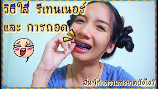 วิธีใส่รีเทนเนอร์ และการทำความสะอาด l vitamint beauty❤️