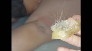 Шугаринг глубокого бикини 18+ . Шугаринг Подмышки. | Waxing woman. Depilation.